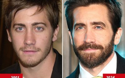 Jake Gyllenhaal – Good Genes Or Good Docs?!