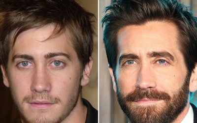 Jake Gyllenhaal — Good Genes Or Good Docs?!