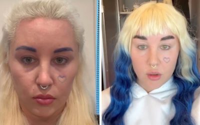 Amanda Bynes Says She’s Gained ‘Over 20 Kilos’ Amid Battle With Despair