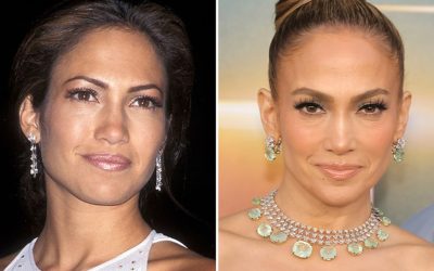 Jennifer Lopez — Good Genes Or Good Docs?!