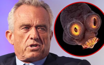 Robert F. Kennedy Jr. Says a Worm Ate Part of His Brain Years Ago