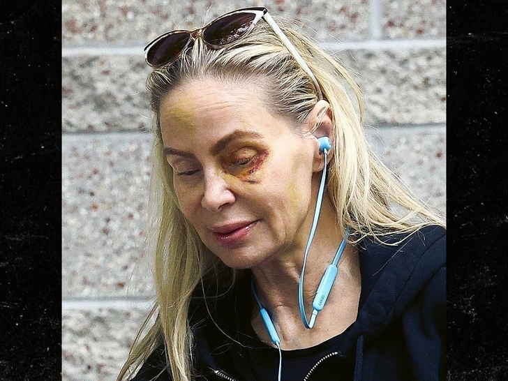 Weston Cage Accused of Battering Mother, Brutal Face Accidents