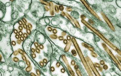 Bird Flu: Symptoms and Treatment During H5N1 Outbreak in California