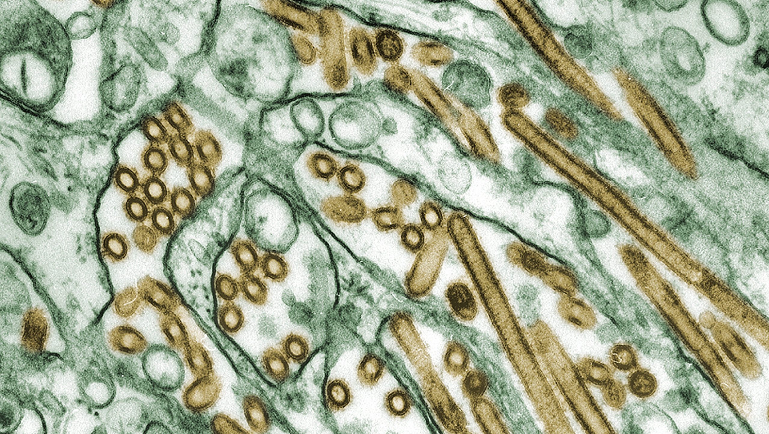 Bird Flu: Symptoms and Treatment During H5N1 Outbreak in California