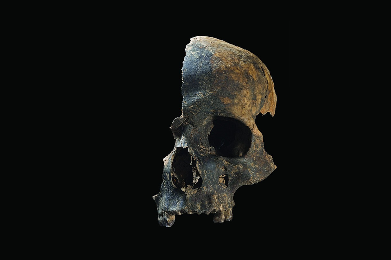 Prehistoric Massacre Uncovered by Archaeologists in Britain