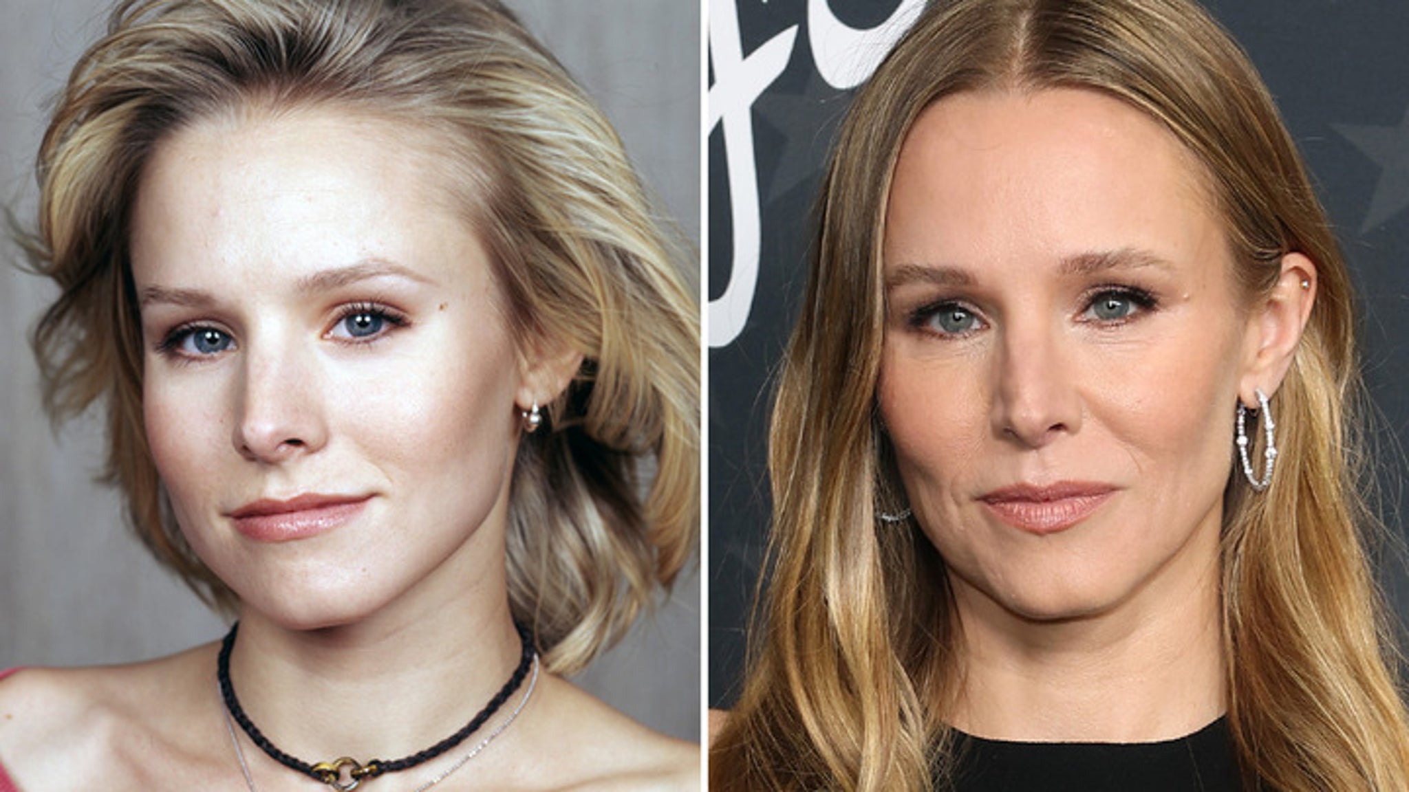 Good Genes or Good Docs? Kristen Bell’s Secret Revealed!