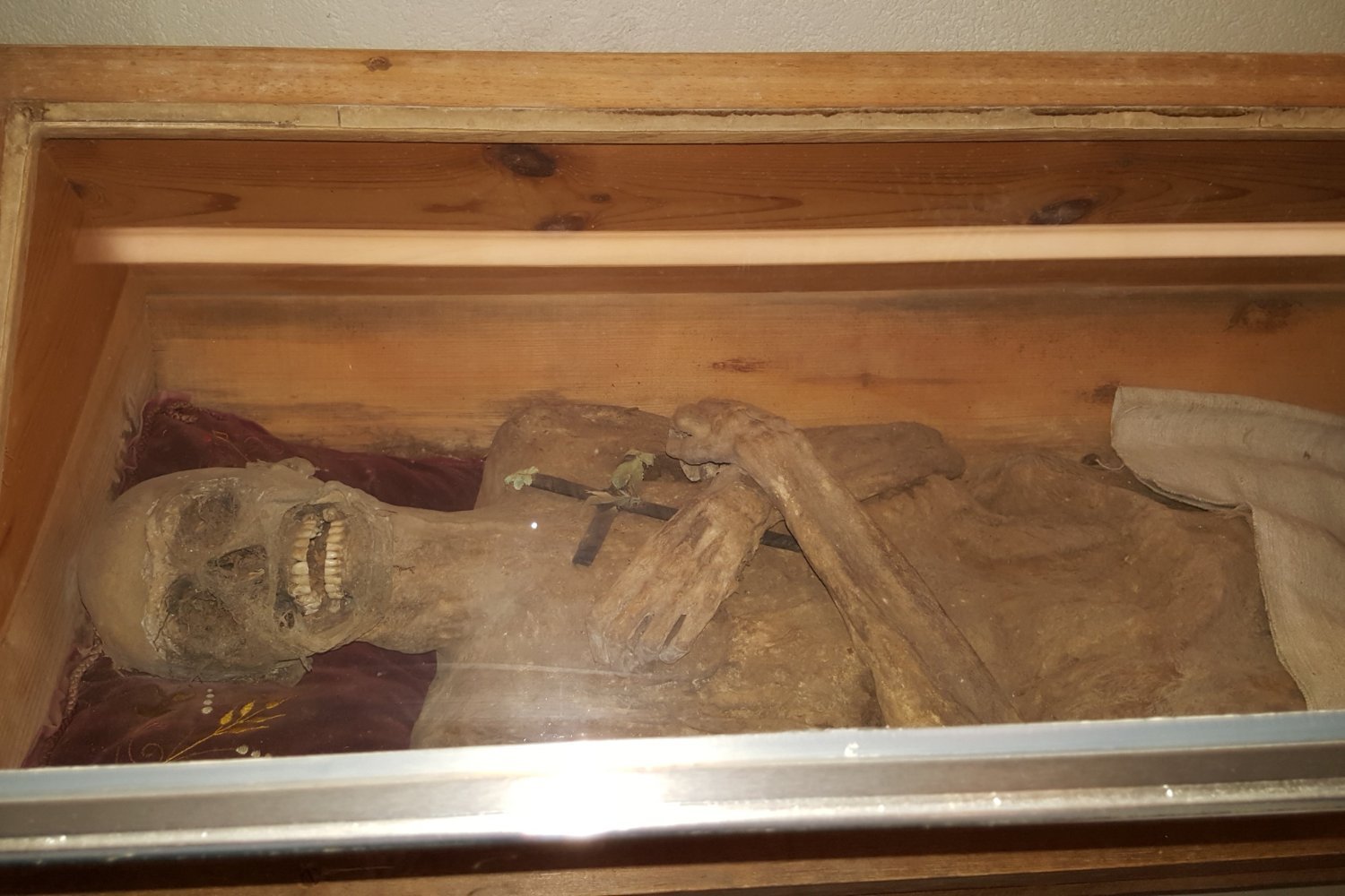 Anal Embalming Method Preserved European Mummy for Centuries