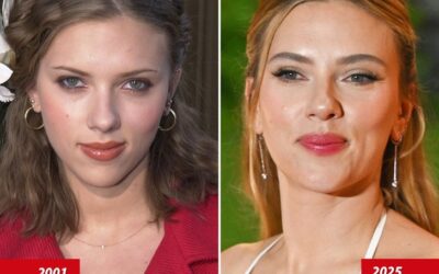 Good Genes or Good Docs: The Truth About Scarlett Johansson