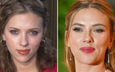 Good Genes or Good Docs? The Scarlett Johansson Debate