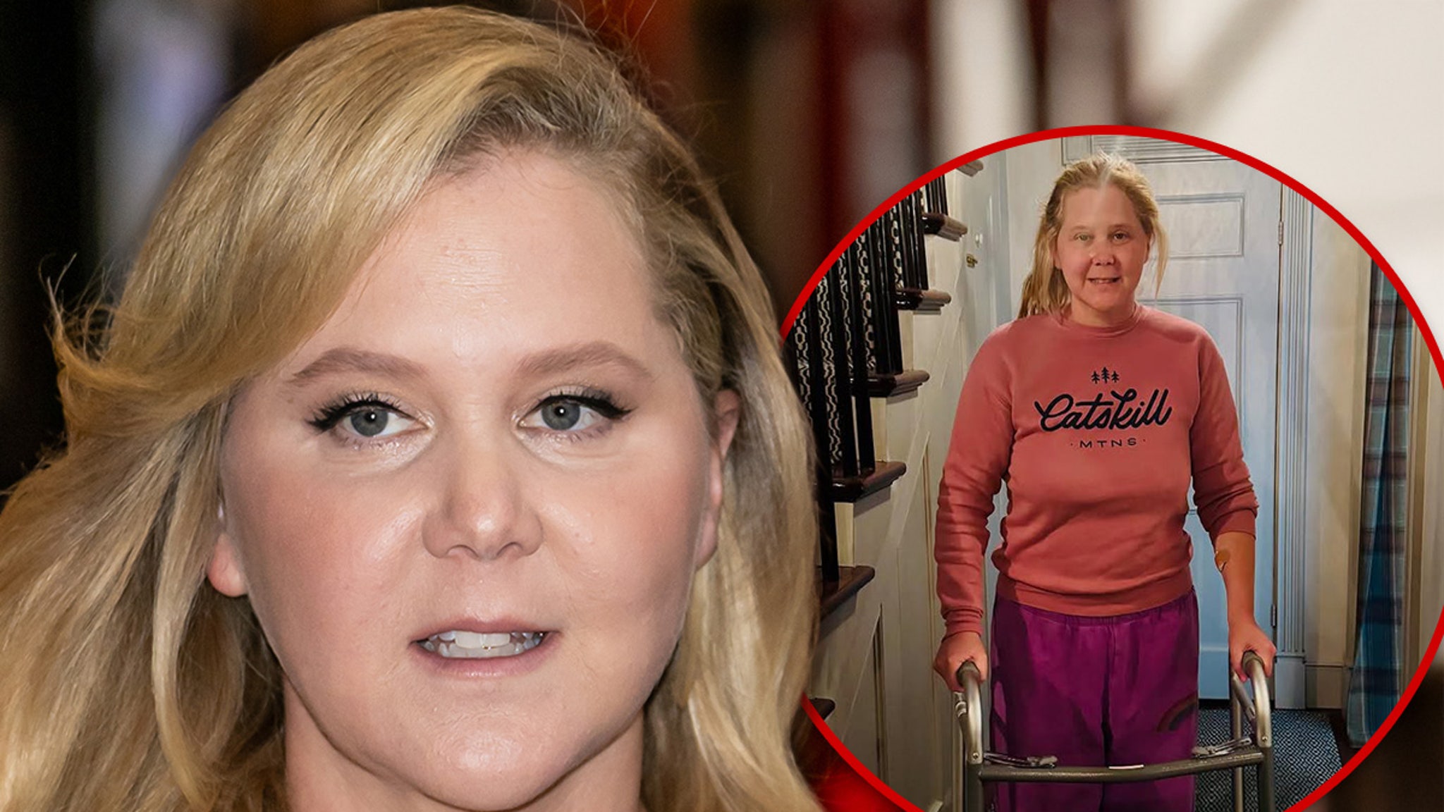 Walker Photo Shared by Amy Schumer Following Spinal Surgery