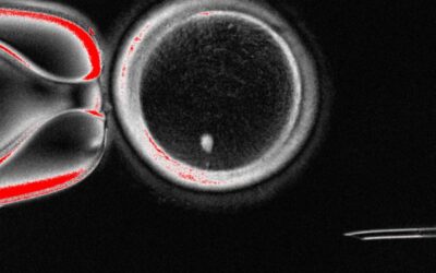 Human Eggs Created from Skin Cells in Breakthrough Study