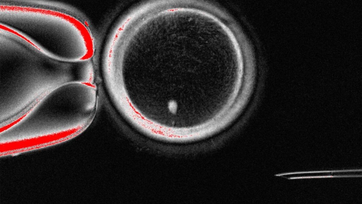 Human Eggs Created from Skin Cells in Breakthrough Study