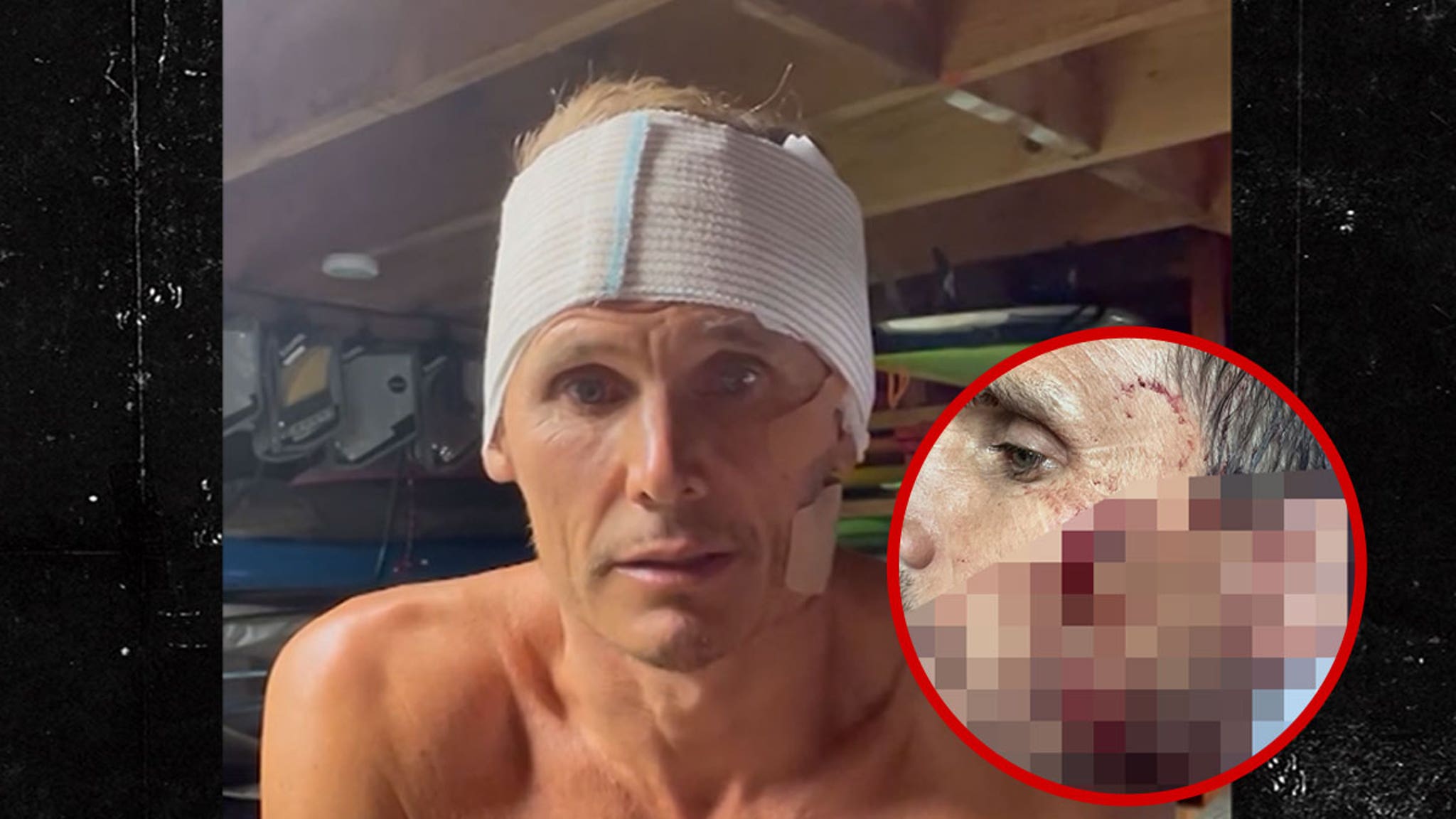 Jamie Mitchell’s Gruesome Wipeout Cuts: A Surfer’s Tale