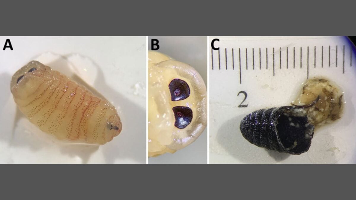 The Woman Who Sneezed Maggots: A Biologically Implausible Case