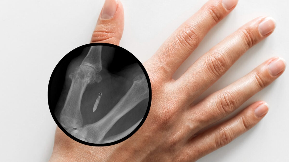 Mandatory Subcutaneous Microchips for Employees May Face Ban in Washington State