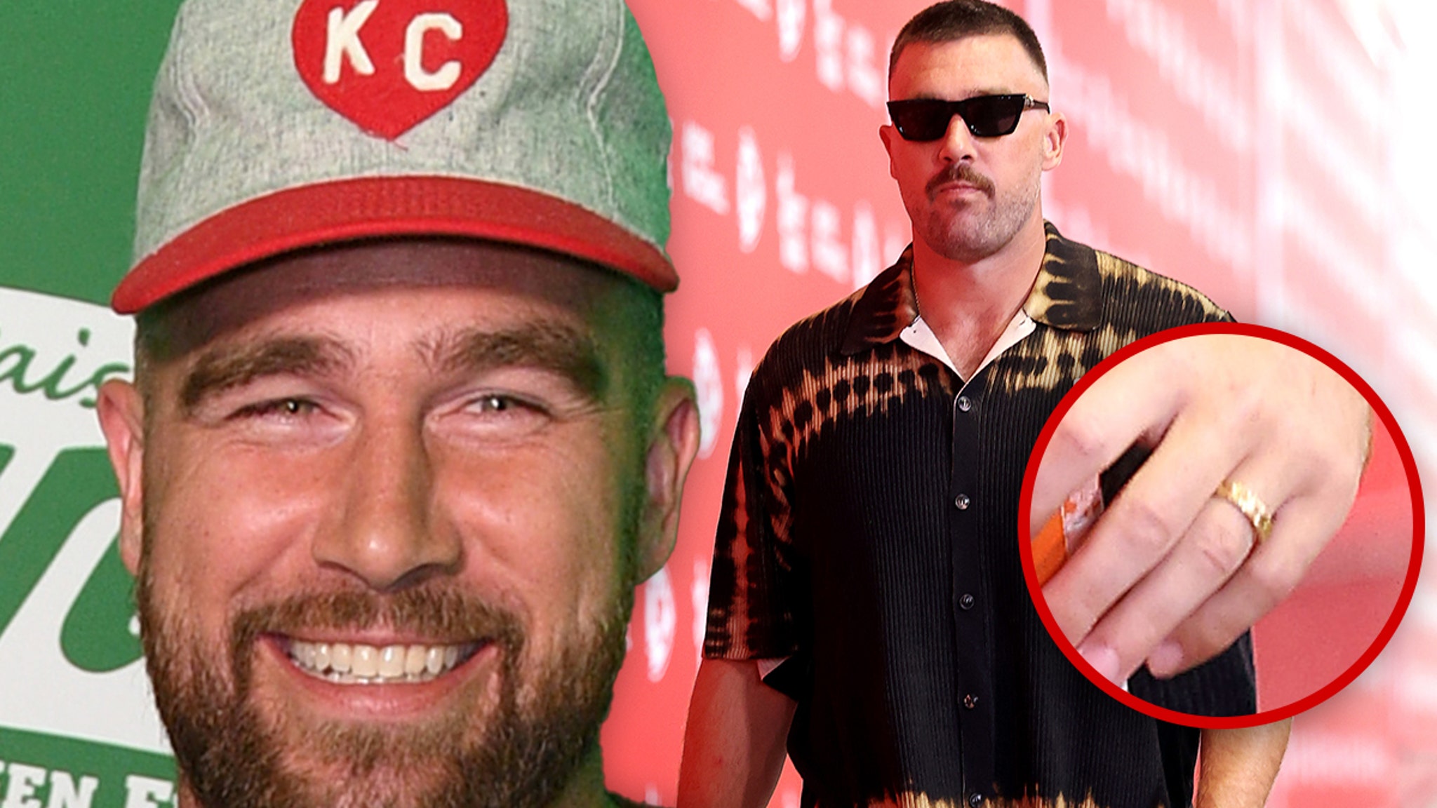 Wedding Band Debut: Travis Kelce at Chiefs Preseason Game Wedding Band Debut: Travis Kelce at Chiefs Preseason Game
