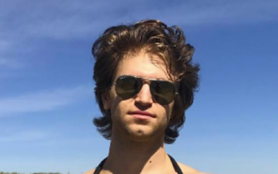 Keegan Allen Robbed at Gunpoint, Displays Injured Face