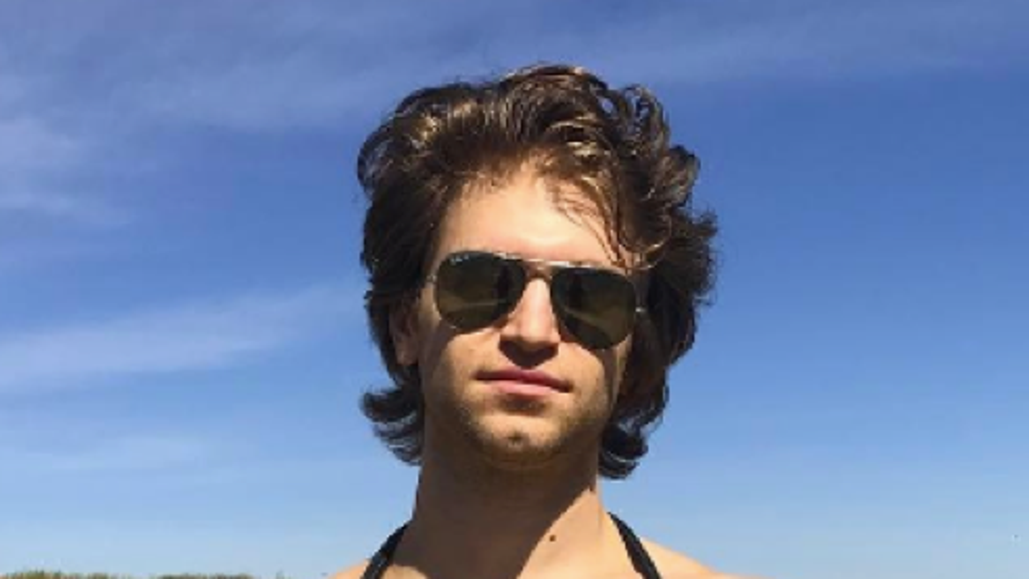 Keegan Allen Robbed at Gunpoint, Displays Injured Face